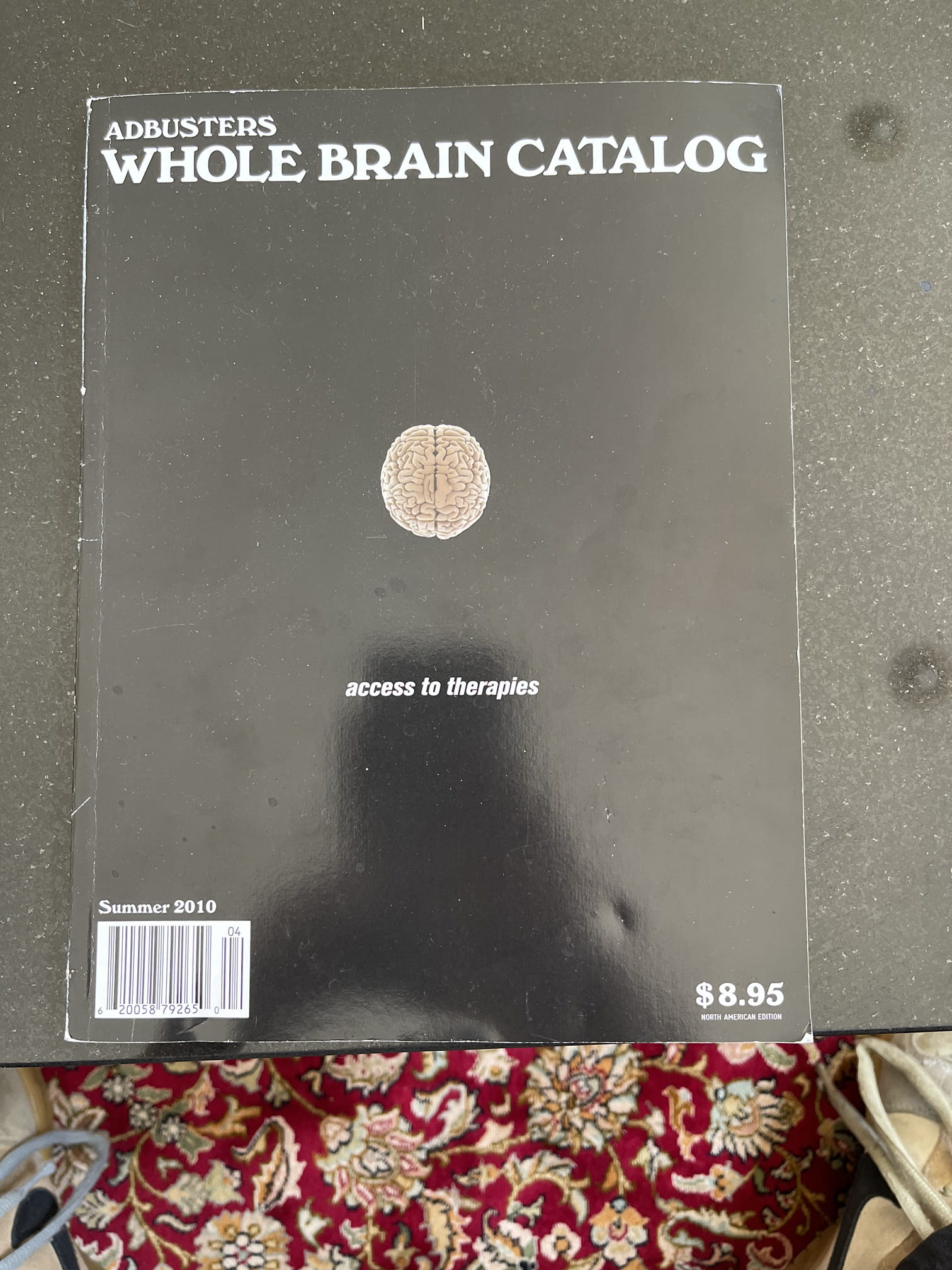 Whole brain catalog