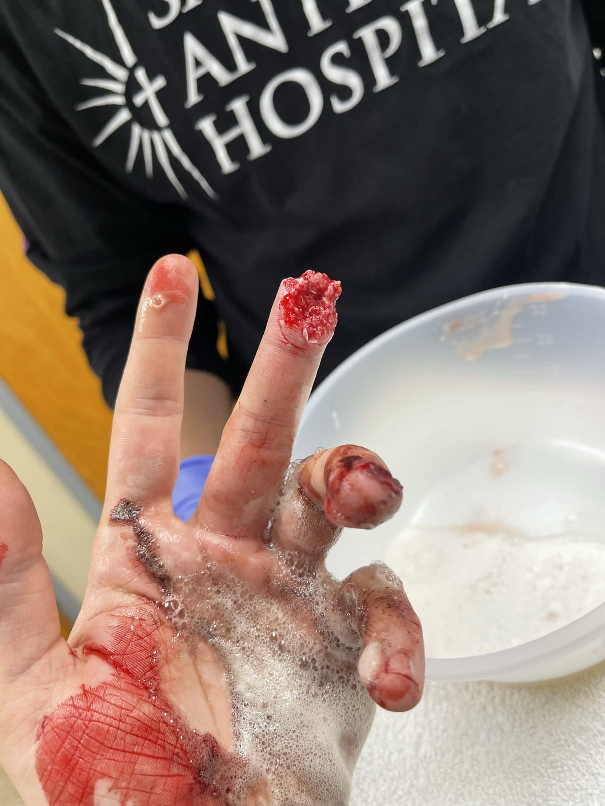 Finger got cut off whoooosss